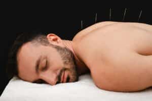 Kann Akupunktur bei Schlaflosigkeit helfen?