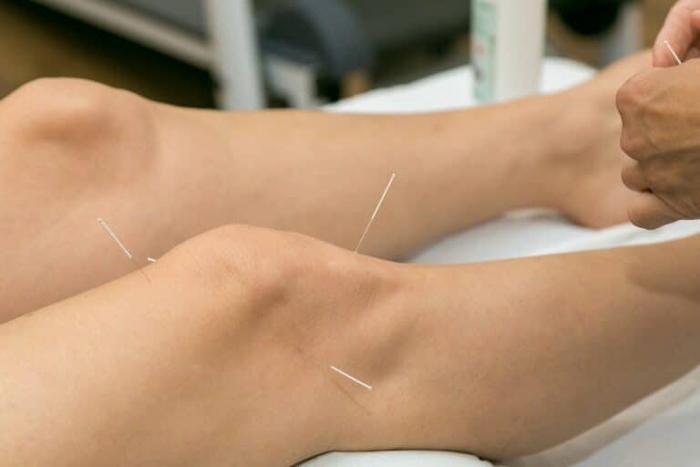Read more about the article Was bringt Akupunktur bei Knieschmerzen?