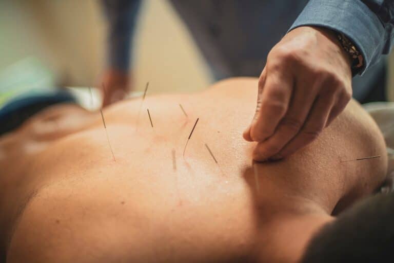 Read more about the article Die Akupunktur bei Halswirbelproblemen (HWS) erklärt