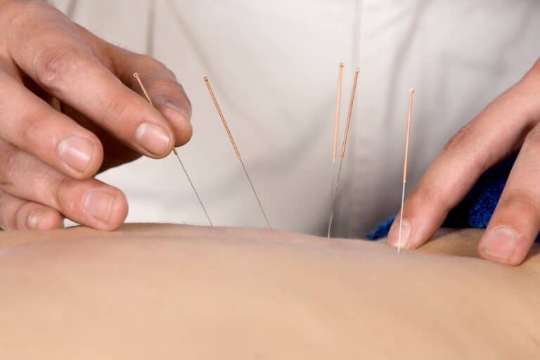 Read more about the article When does acupuncture start to help? Insight and guide to effectiveness