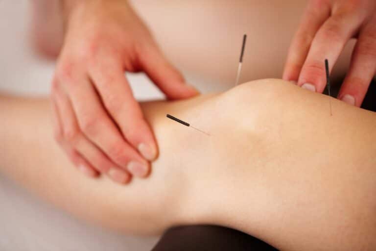 Read more about the article Possible applications of acupuncture: What you should know