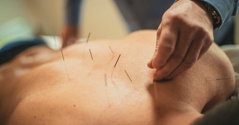 Mehr über den Artikel erfahren Akupunktur bei MS Patienten: Eine ergänze Unterstützung