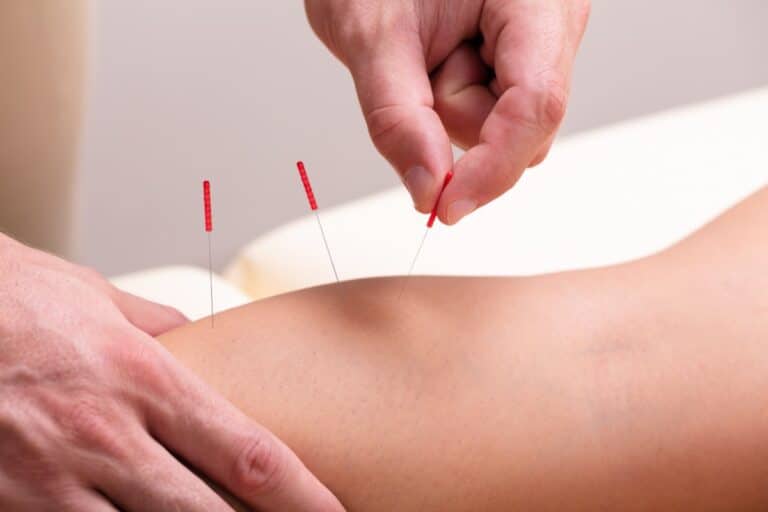 Read more about the article Knieschmerzen lindern mit Akupunktur: Was Sie wissen müssen
