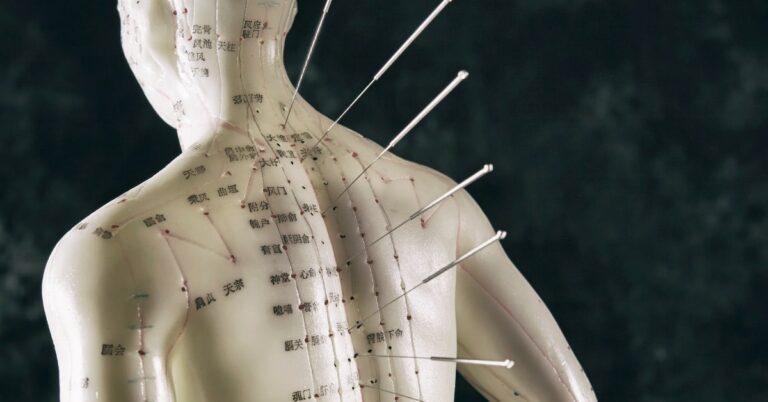Mehr über den Artikel erfahren Die Auswirkung der Akupunktur auf Emotionen