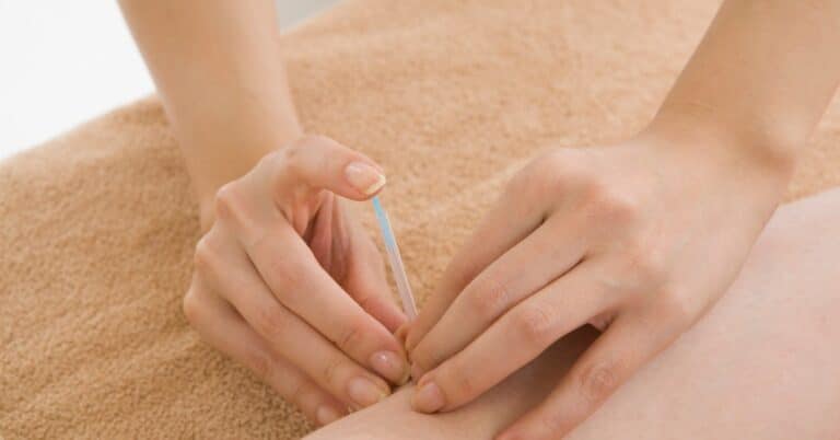 Read more about the article Akupunktur bei Wassereinlagerungen