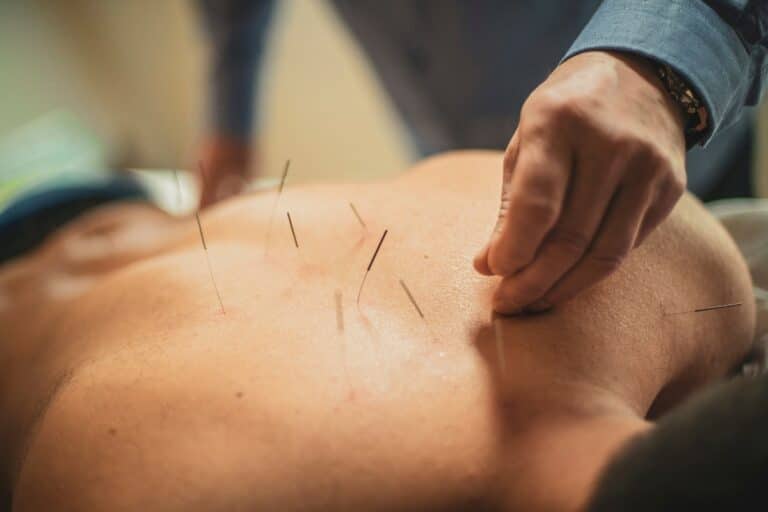 Ist Akupunktur schmerzhaft?
